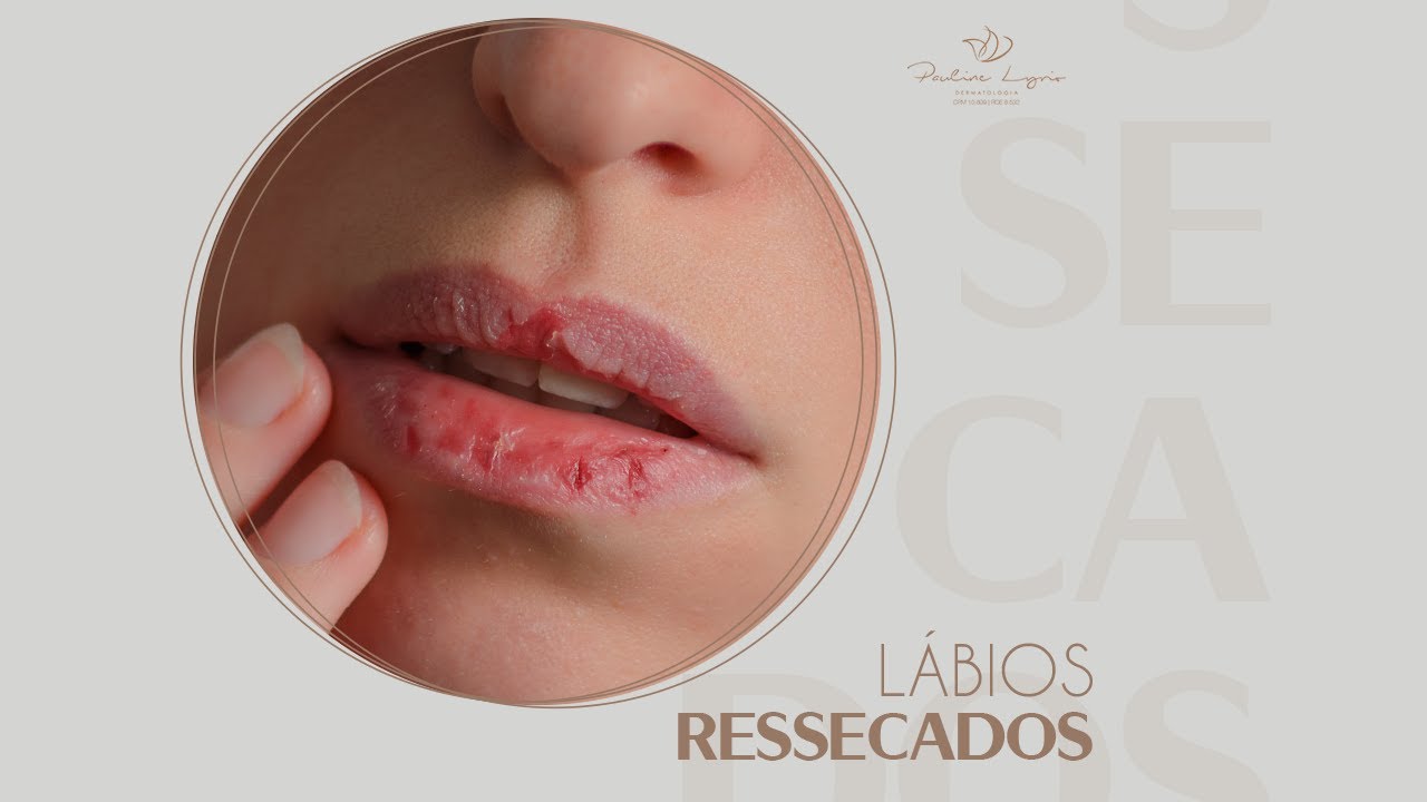 Dicas para tratar lábios ressecados no inverno