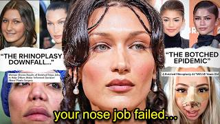 CONGRATULATIONS, YOUR NOSE IS DESTROYED...