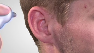 Connex® Spot Monitor (CSM) Training video in het Nederlands