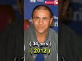 Faudel فوضيل Before After