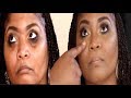 HOW TO: Makeup for dark under eye circles & sunken eyes | Darbiedaymua