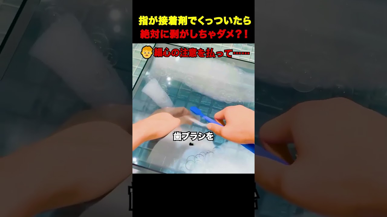 接着剤で指がくっついたら絶対にこれをするな 😳🖐️