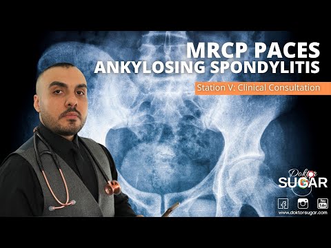 Video: 5 Petua Mengatasi Keletihan Ankylosing Spondylitis