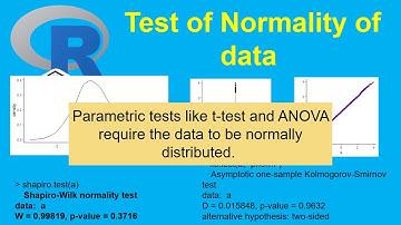 Mastering Normality Tests in R: Graphical & Statistical Methods | Statistics with R