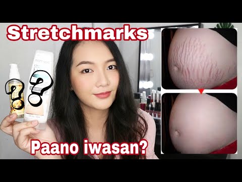 Video: 3 Mga Paraan upang I-minimize ang Mga Marka ng Stretch Sa panahon ng Pagbubuntis