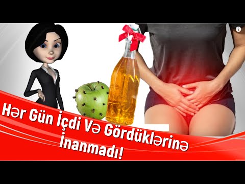 Video: Pitiya dedikdə nə nəzərdə tutulur?