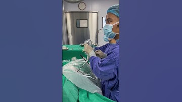 Tán sỏi thận qua da | BÁC SĨ TÙNG TÁN SỎI