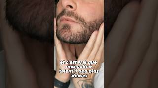 Comment faire pousser sa barbe plus vite avec l’huile de ricin