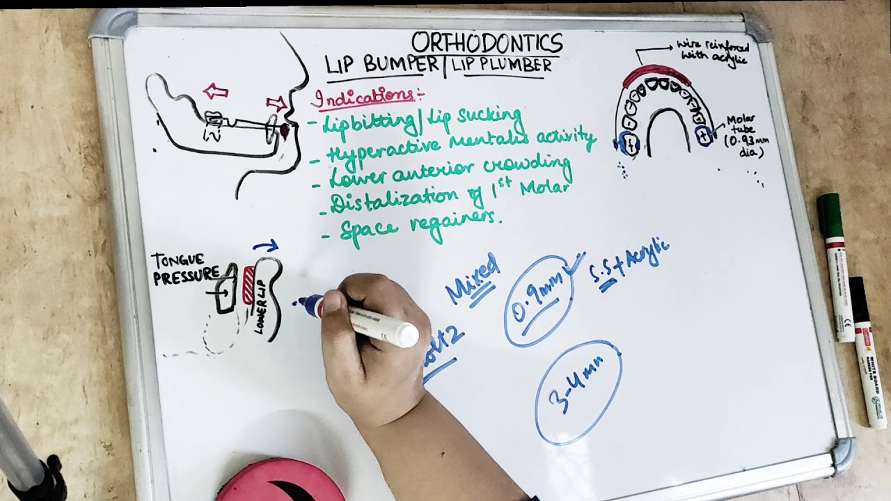 lip bumper orthodontic appliances YouTube