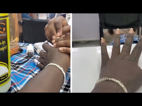 STICKONS DESTROY YOUR NAILS.DO THIS INSTEAD