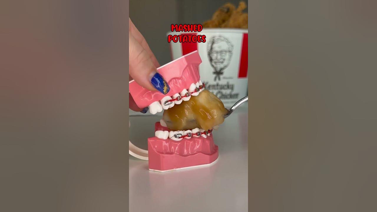 how-to-eat-kfc-with-braces-on-braces-safe-foods-from-kentucky-fried