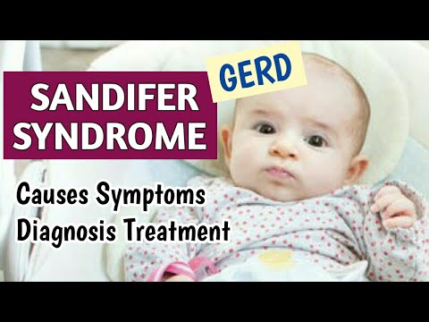 Sandifer Syndrome GERD കാരണങ്ങൾ, ലക്ഷണങ്ങൾ, രോഗനിർണയം, ചികിത്സ | ഹിയാറ്റൽ ഹെർണിയ | പീഡിയാട്രിക്സ്