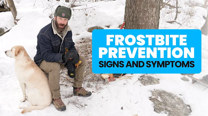 Frostbite Signs And Symptoms