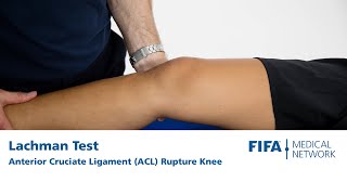 Lachman Test | Anterior Cruciate Ligament (ACL) Rupture Knee