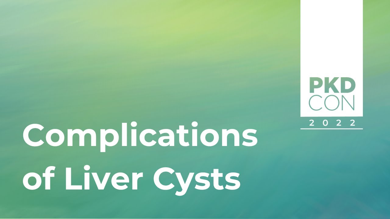 Complications Of Liver Cysts Youtube