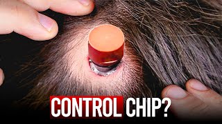 This Will CHANGE EVERYTHING: Implants in The Human Brain