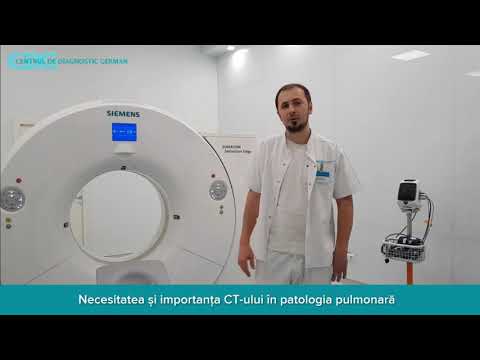 Necesitatea și importanța CT-ului în patologia pulmonară