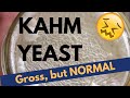 Kahm Yeast Is NORMAL On Fermenting Veggies Kahm Yeast Is NORMAL On Fermenting Veggies