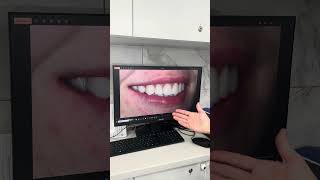 Тотальная реабилитация