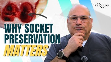 What REALLY Happens to Your Jawbone After Tooth Extraction