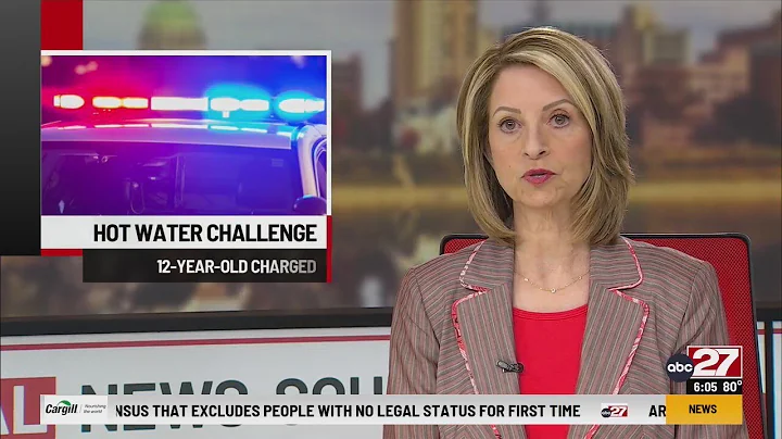 Lancaster County boy charged with pouring boiling water on brother in 'social media prank'