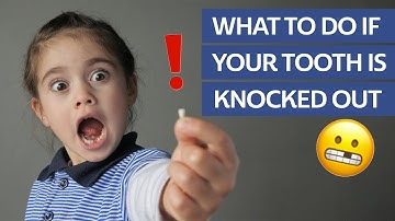 What to Do If Your Tooth Is Knocked Out