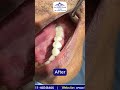 Transform Your Smile with Advanced Dental Care | Best Smile Makeover in Delhi