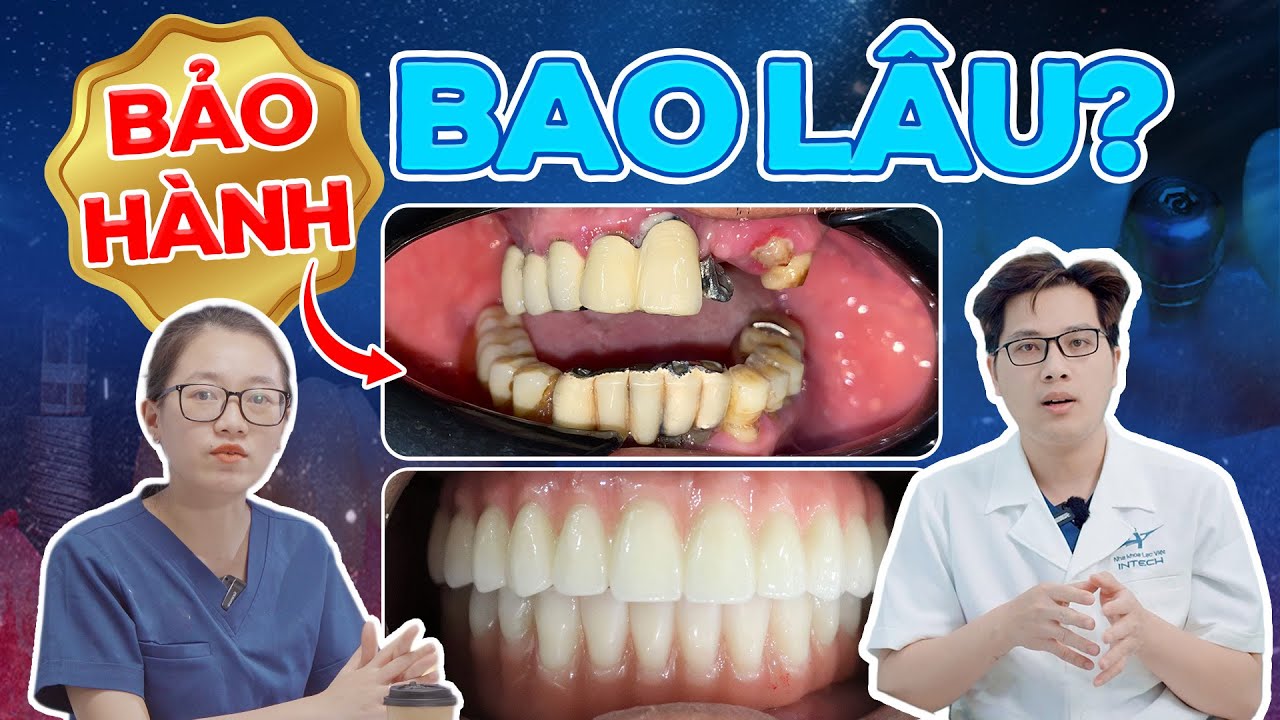 Outline Video Trồng Răng Implant Có Bảo Hành Không? Bảo Hành 1:1 Tại Lạc Việt Intech Áp Dụng Với 2 Trường Hợp Này!