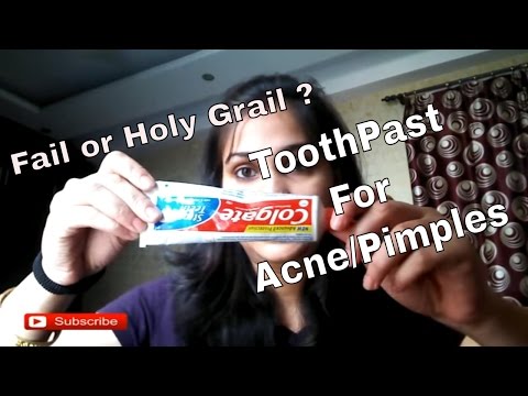 How Toothpaste can help get rid of Acne and Acne Marks | Nidhi Katiyar