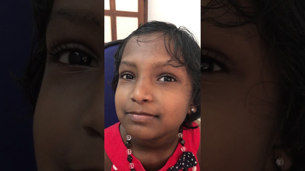 Cleft palate surgery - before and after video with clear speech @ www.facesurgeon.in