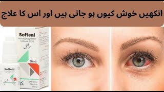 Softeal Eye Drops Uses In Urdu L Dry Eyes Symptoms L Dry Eyes Treatment In Urdu L Dry Eyes Drops