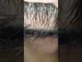 ASMR Relaxing Massage therapy video #asmr #beard #hair #ingrownhair #shorts #trending #video