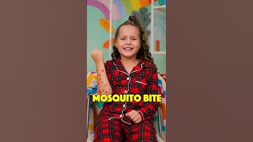 Let’s Learn About SICK DAYS — COLDS, TOOTHACHE & DIZZINESS! 🤕🧠 #shorts #health