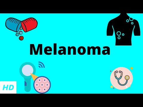 Melanoma, Causes, Signs and Symptoms, DIagnosis and Treatment.