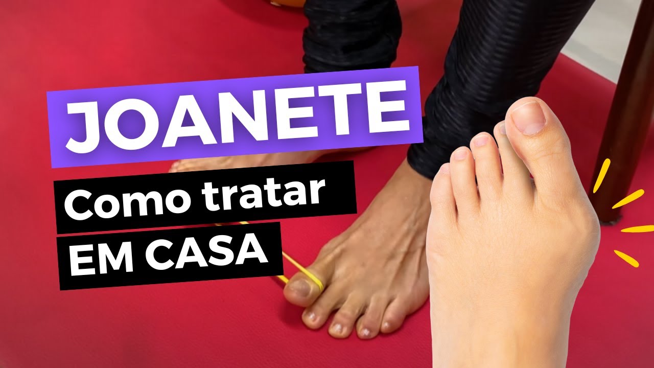 JOANETE: Como aliviar dores e tratar em casa com 8 exercícios (AULA COMPLETA) #treinecomigo