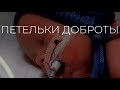 Петли для жизни / Новорожденные / Недоношеные дети / Псковский перинатальный центр