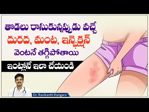 How to Treat Skin Fungal Infection | Candid Cream Benefits | Reduces Ringworm | Dr.Ravikanth
