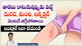 How to Treat Skin Fungal Infection | Candid Cream Benefits | Reduces Ringworm | Dr.Ravikanth Kongara