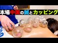 【第２弾】本場中国仕込みの 吸玉 （ CUPPING ）と 鍼（ はり ）: 肩こり 腰痛 頭痛 などが改善！ 松田幸代の秘儀公開 : 体験者 岩田朱理 : 制作 茅ヶ崎テレビ