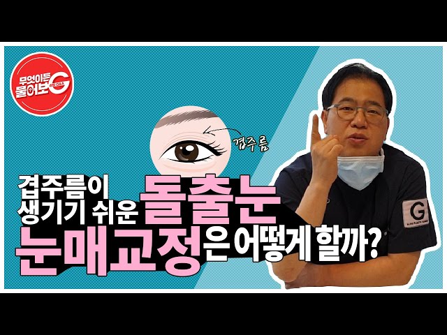#돌출눈쌍수 ! 겹주름이 생기기 쉬운 돌출눈, 눈매교정은 어떻게 할까?