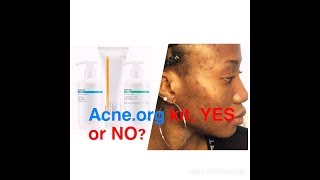 Acne.Org Regimen. ONE WEEK UPDATE| UNSPONSORED REVIEW WITH BEFORE AND AFTER PICTURES