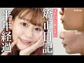 【矯正日記#06】矯正して半年経過！ゴボ口改善してきた？頬コケてきた？【アンカースクリュー矯正】by 桃桃
