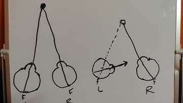 Concept of Squint, Normal and Abnormal Retinal Correspondence 