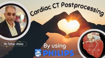 Cardiac Ct Processing Workflow On IntelliSpace Portal(Philips) شرح معالجة فحص القلب بالأشعة المقطعية