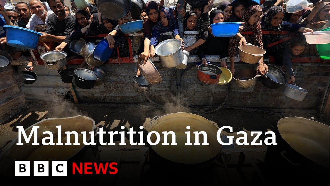 Gaza health ministry says 33 people dead from malnutrition in last 48 hours | BBC News Gaza health ministry says 33 people dead from malnutrition in last 48 hours | BBC News