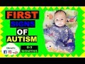 Infant First Signs OF AutisM 0-3 Months