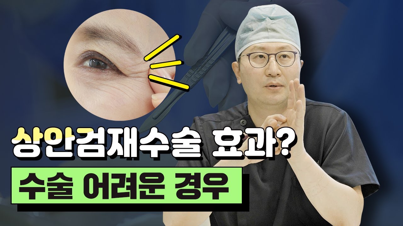 상안검 재수술 효과 있을까?│상안검 재수술 쉬운경우 vs 어려운 경우 — 유튜브 영상 썸네일