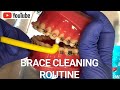 THE BEST Braces Cleaning Routine! Top Tips & Hacks! How to Clean Your Braces-Orthodontist EXPLAINS!