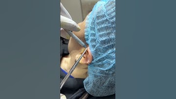 Xỏ một lúc 3 vị trí trên tai tại cửa hàng TinyBox