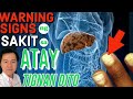 Warning Signs ng Sakit sa Atay (Liver Problem, Fatty Liver, Liver Cirrhosis)- Payo ni Doc Willie Ong